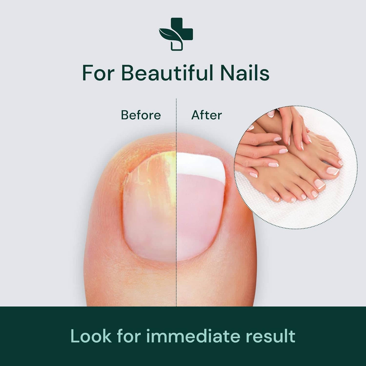 Nails Strong Growth And Repair Oil (Buy 1 Get 1 FREE)